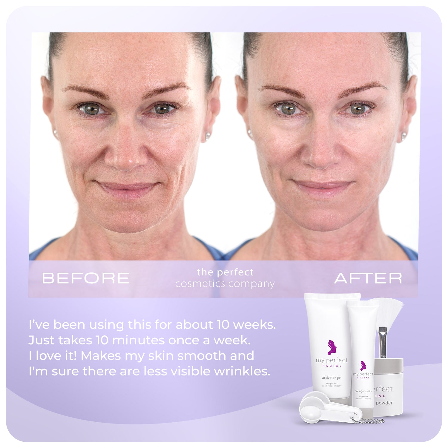 My Perfect Facial before and after results improving skin texture, smoothing fine lines and wrinkles, indicating firmer looking skin