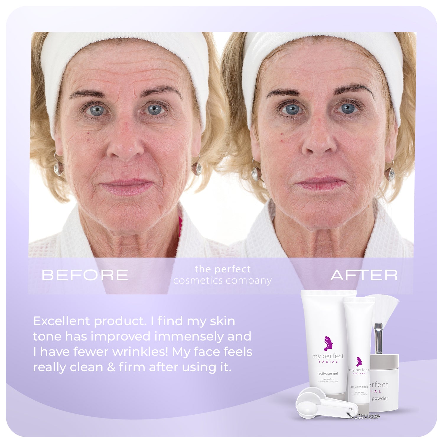 My Perfect Facial before and after results improving skin texture, smoothing fine lines and wrinkles, indicating firmer looking skin