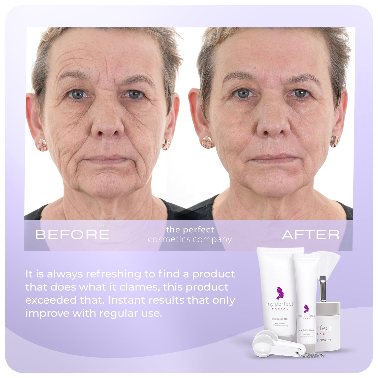 My Perfect Facial before and after results improving skin texture, smoothing fine lines and wrinkles, indicating firmer looking skin
